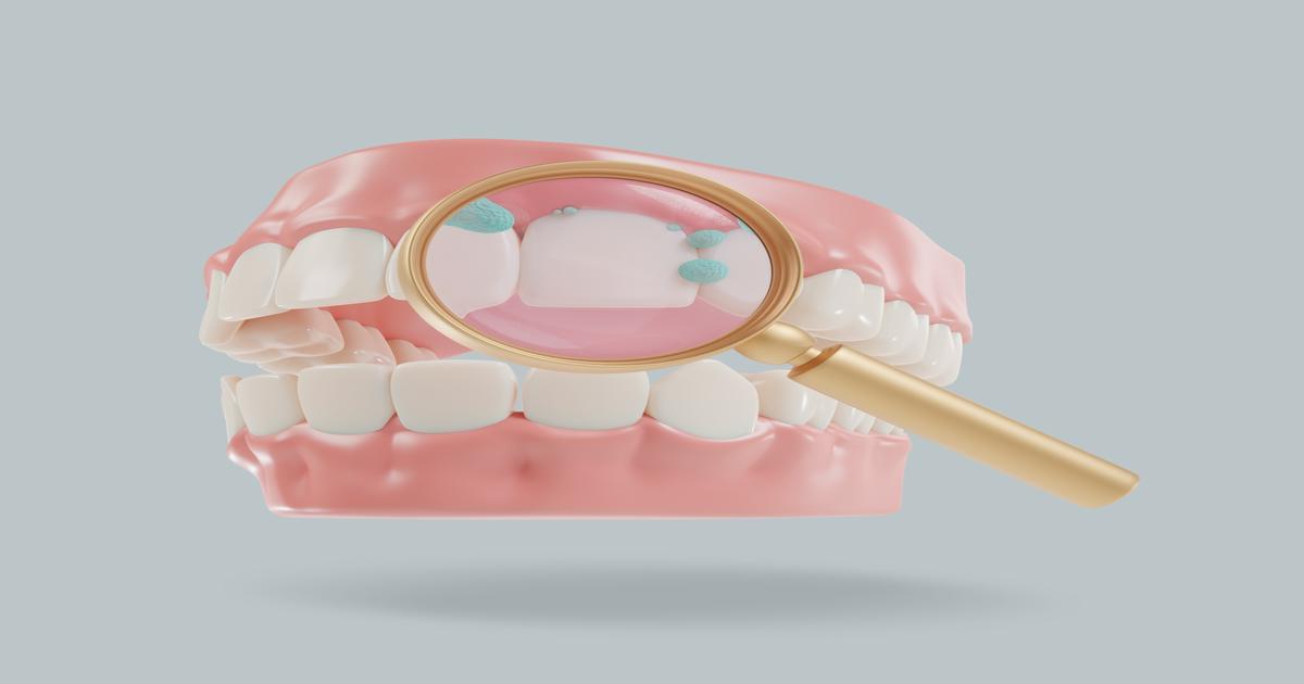 치아보험 FAQ 대표이미지