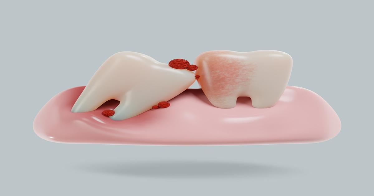 치아보험료 비교 대표이미지
